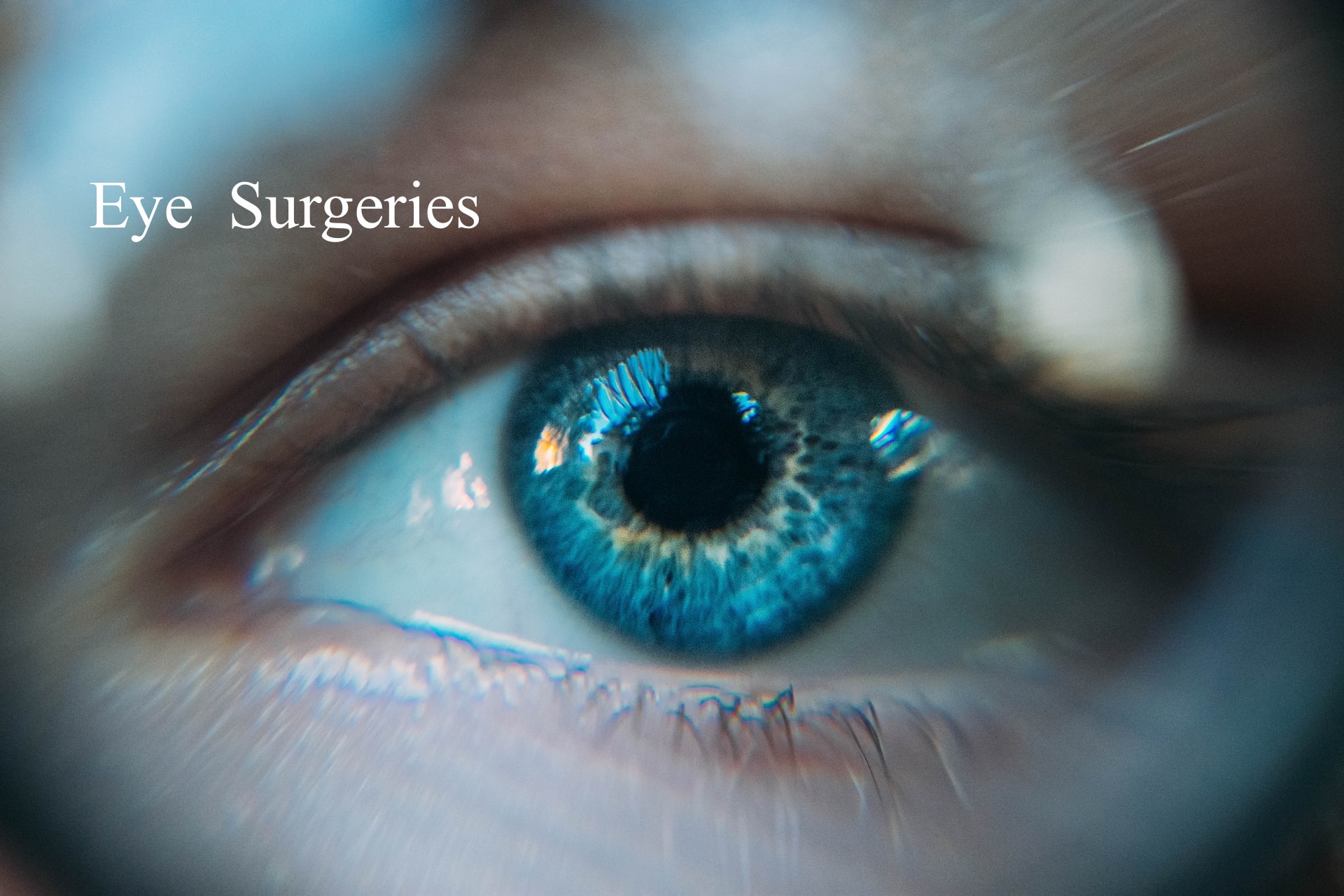 Eye Surgery in Iran